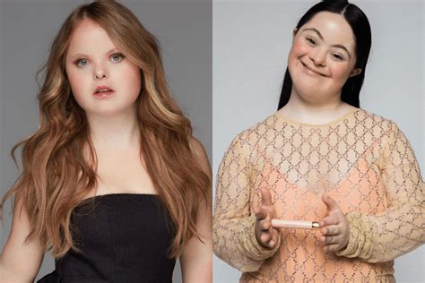 Modelle con sindrome di Down: chi sono Ellie Goldstein e Beth